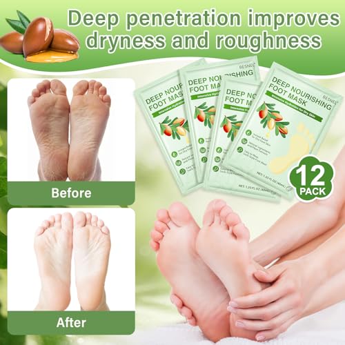 Foot Peeling 8Pcs£¦12Pcs Moisturizing Foot Mask, Exfoliator Peel Calluses Dead Skin Callus Remover, Hydrating Foot Masks for Dry Cracked Feet, Repair Rough Heels£¦Dry Skin for Baby Soft and Smooth Feet