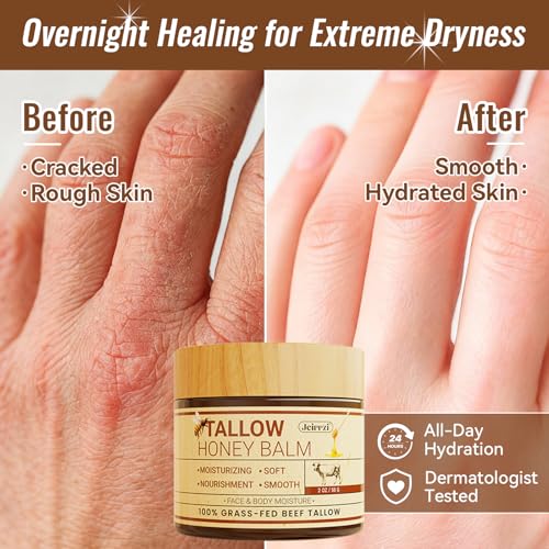 Organic Beef Tallow for Skin, 100% Grass-Fed Tallow and Honey Balm for Face Body Moisturizer for Aging Dry Sensitive Skin, Deep Hydration & Nourishment 2 OZ