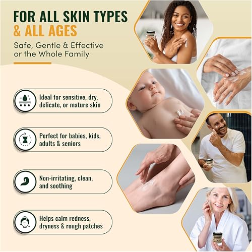 Natural Organic Tallow Balm For Skin That Rejects Synthetic Lotion - Handmade Beef Tallow and Manuka Honey Balm Face Moisturizer for Dry Cracked Hands and Aging Skin - Award Winning