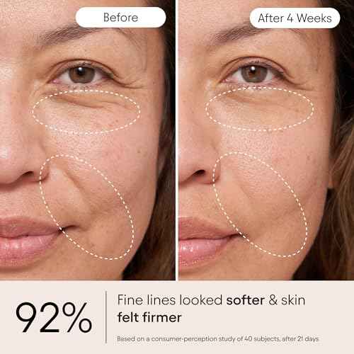 Alpyn Super Peptide & Ghostberry Moisturizer for Eczema, Barrier & Wrinkle Repair | Calm & Soothe Against Redness & Irritation (0.5 Oz)