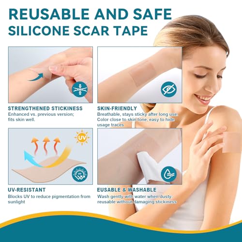 Silicone Scar Tape for Surgical Marks Face Stick Keloid Cover C-Section Strips Wrinkle Cream Lip Sleeping Gel Sheet Tummy Patch Hydrocolloid Roll Soft (1 Pack, 1.6"X 120")