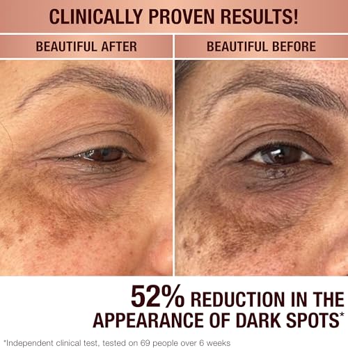 SHANI DARDEN SKIN CARE Lactic Acid Face Serum Travel Size, Active Night Serum to Help with the Look of Radiant and Smooth Skin, Gentle But Powerful Face Exfoliator, 0.34 fl oz