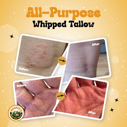 Magic Moo All Purpose Whipped Beef Tallow Skincare for Acne, Eczema, Dry Skin, Moisturizer, Stretch Marks & Hydration. Suet Tallow for Face with Organic Emu Oil. Contains All Organic Ingredients, 2oz