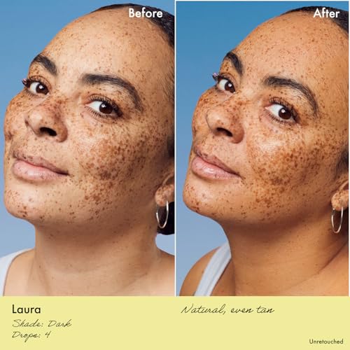 Remedy for Dark Spots | Advanced Night Treatment with Retinol & Kojic Acid | For Discoloration and Uneven Tones | With Glutathione, Niacinamide, Mandelic Acid | By Dermatologist Dr. Shah, 1 fl. oz