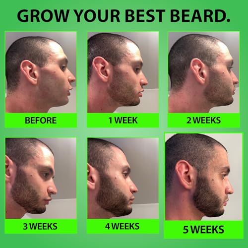 Minoxidil for Beard Growth ? 5% Serum with 2X Biotin & Rice Water, Promotes Thicker, Fuller Facial Hair, Ideal for Patchy Areas, Revitalizes Follicles