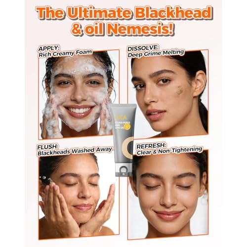 CKA Amazonian White Clay Facial Cleanser for Oily Skin - Deep Pore Detox & Blackhead Remover Face Wash with Witch Hazel & Vitamin B5 - Daily Foaming Face Wash for Oily Control/Sensitive Skin 2 Pack