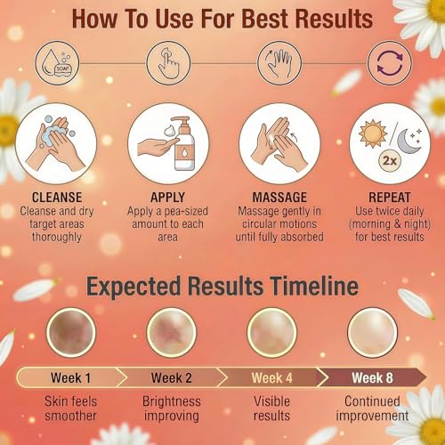 Dark Spot Remover for Body, Lightweight Fast-Absorbing Cream for Uneven Skin Tone, Dark Spot Corrector for Elbows, Knees, Underarms & Inner Thighs, 1.76 Fl Oz
