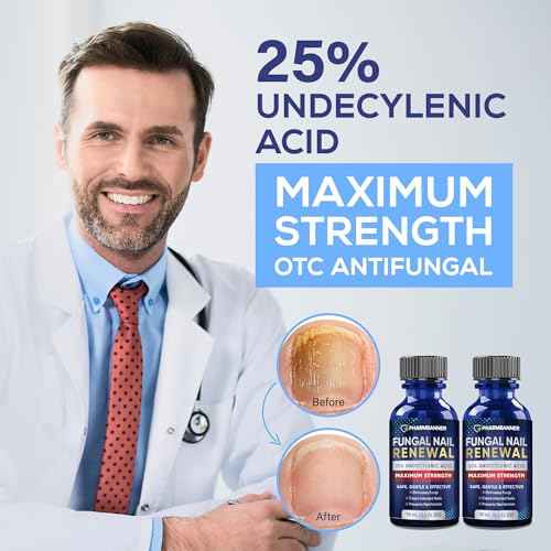 Toenail Fungus Treatment Extra Strength: 25% Undecylenic Acid Toe & Fingernail Fungus Renewal - Nail Fungus Treatment Kit with Brush & File - For Ingrown Nails & Discoloration
