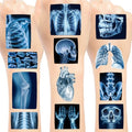 144PCS Radiology X Ray Temporary Tattoos Stickers Radiology Themed Party Favors Supplies Birthday Party Decorations