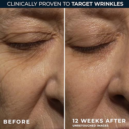 RoC Retinol Correxion Deep Wrinkle Anti-Aging Night Cream,Daily Face Moisturizer with Shea Butter,Glycolic Acid and Squalane,Skin Care Treatment,Mini 0.5 Ounces (Packaging May Vary),(Pack of 2)