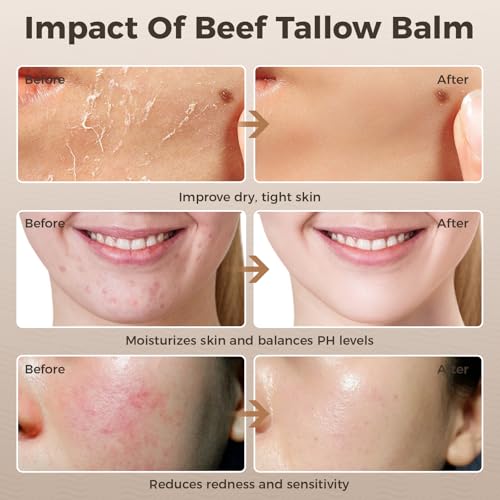 Ofanyia Beef Tallow for Skin, Whipped Tallow Cream for Sensitive Skin, Tallow Face Moisturizer for Repairing Damaged Dry Skin, Natural Beef Tallow Grass Fed Lotion for Skin Care, 4 oz (UNSCENTED)