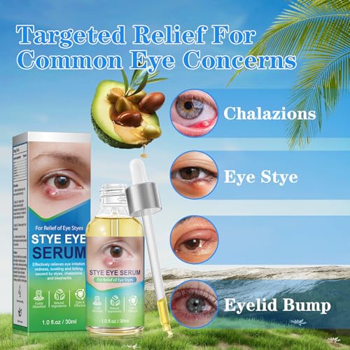 Stye Eye Relief Serum & Eyelid Drops for Blepharitis, Chalazion Styes Redness | Under Eye Serum Natural, Stye Drops for Infected Eyes Fast-Acting | Gentle Care 30ml
