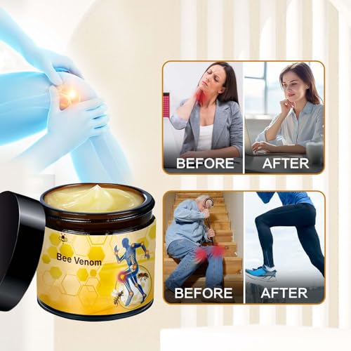 2PCS Bee Venom Cream, Bee Venom Gel, Professional Bee Venom Cream, Suitable for Back, Knee, Hands, Neck, Feet