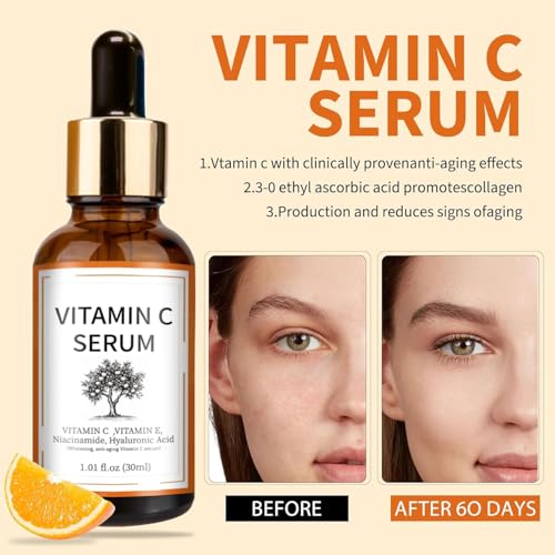 Vitamin C Brightening Serum with Hyaluronic Acid & Vitamin E ? Dark & Even Skin Tone for Women (30ml/1.01 fl.oz.)