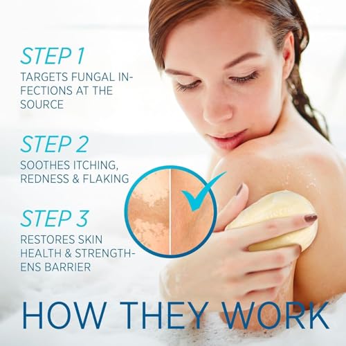 Tinea Versicolor Relief Cream & Soap Kit - Helps with Tinea Versicolor, Fungal Skin Conditions ? Soothes, Cleanses, and Restores Skin Health