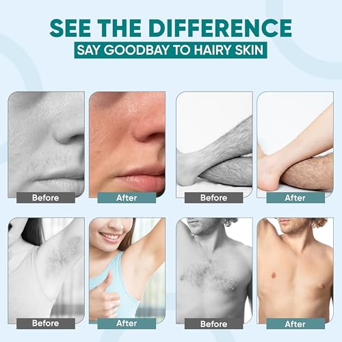 Amira Beauty 200 Non Woven Wax Strips for Hair Removal - Gentle Wax Paper for Waxing Face, Bikini, and Body - Pre Cut, Tear Resistant Small and Large Strips