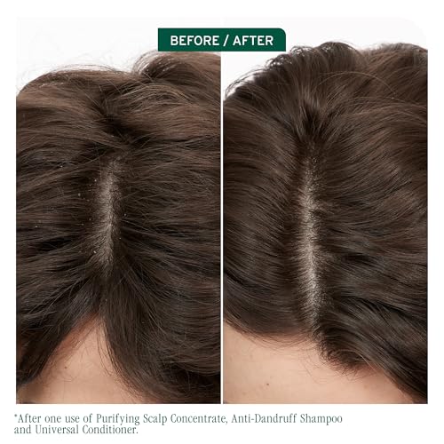 Biolage Scalp Sync Anti-Dandruff Shampoo - Controls Itchy Scalp, Deeply Cleanses Hair, Moisturizing Dandruff Treatment, With Zinc Pyrithione, Vegan & Cruelty-Free, 1.7 FL Oz