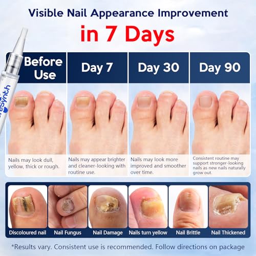 Extra Strength Nail Fungus Repair Pen (OTC Maximum Strength), 25% Undecylenic Acid + Aloe & Vitamin E, For Thick Yellow Discolored Nails,24mL (0.41 fl oz) Total, 8-Pack, Designed in USA