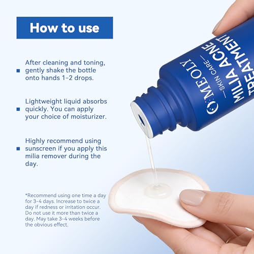 Milia Remover for face and eyes: Milia remover treatment with 3% Salicylic Acid for Acne exfoliant, Advanced formula for Men and Women 30ML