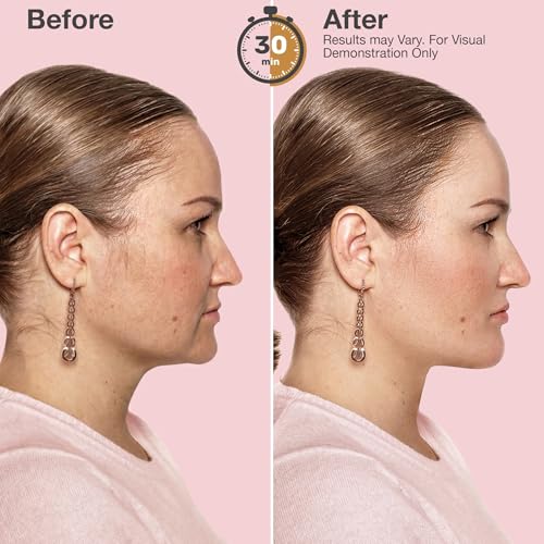 V Line Lifting Neck & Chin Mask ? Jawline Shaper & Double Chin Reducer ? Face Lift & Skin Tightening ? Retinol, Collagen, Hyaluronic Acid & Aloe Vera ? Anti-Aging Neck Firming Mask ? 5 Pack
