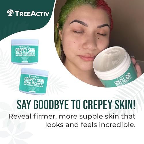 TreeActiv Crepey Skin Repair Cream, 2-Pack, Firming Cream For Face and Neck, Skin Firming and Tightening Lotion with Hyaluronic Acid, Designed to Hydrate Dry, Crepey-Looking Areas, 1000+ Uses