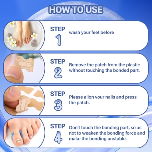 Toenail Fungus Treatment Extra Strength, Ingrown Toenail Treatment, 80 Pcs Glue-Free Breathable Corrector Patches, Professional Ingrown Toenail Tools, Not Prone to Falling Off, with File