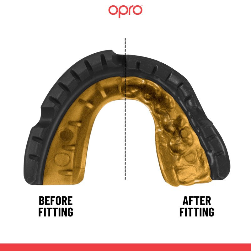 Adult Mouth Guard for Braces - Boxing, MMA & Football Protective Gear