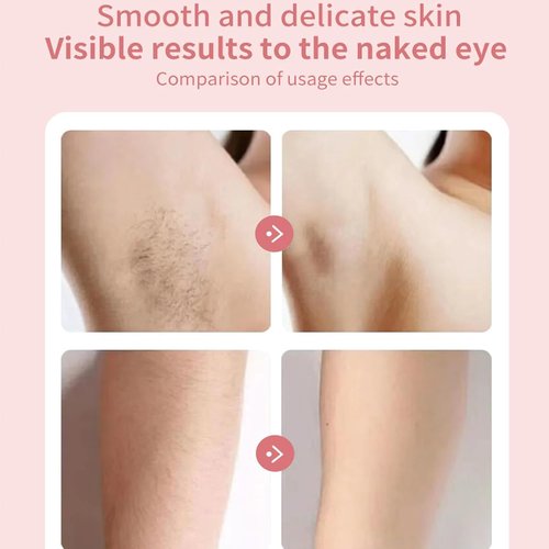 ENVGSOMP Silkglide Pro - 2024 Best Silk Glide Razor, Silk Glide Epilator Painless Hair Removal at Home, 2 in 1 Electric Shaver Razors for Women, Wet & Dry (Pink)