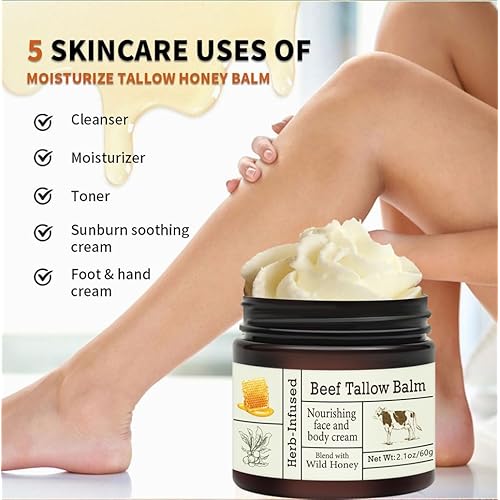 After Sun Lotion with Aloe Vera - Ultra Cooling Aloe Vera for Sunburn Hydration with Cocoa Butter & Rosehip Oil - Hydrating Aloe Lotion After Sun Moisturizer for Dry Skin with Hyaluronic Acid