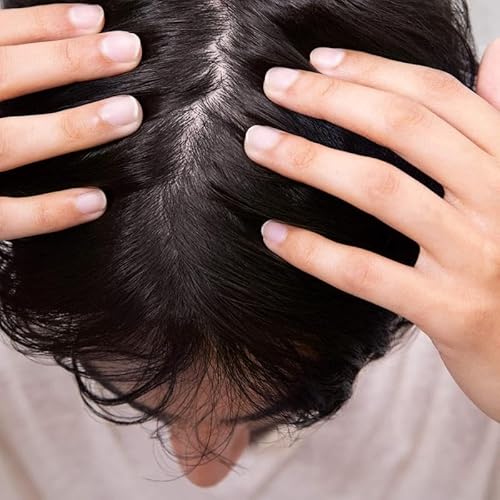 Hairitage Wash It Away Anti-Dandruff Shampoo - For Flaky, Itchy, Oily Scalp - Dandruff Shampoo Treatment - Eliminate Scalp Itching + Irritation + Flaking - 13 fl oz