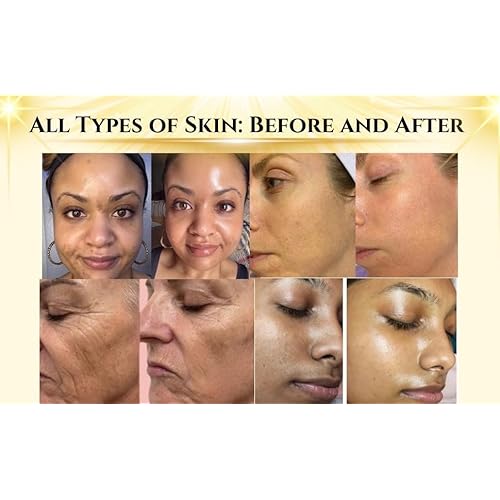 Advanced Power Snail Mucin Serum 96% Snail Filtrate with Hyaluronic Acid & Peptides for Hydration, Skin Repair, and Radiant Glow ? Korean Anti-Aging & Moisture Barrier Care