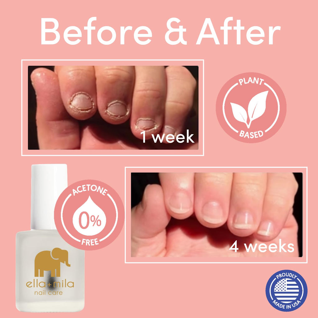 ella+mila "No More Biting" Nail Polish - Bitter Taste Nail Biting Treatment for Kids & Adults - Effective Thumb Sucking Stop for Kids (0.45 fl oz)