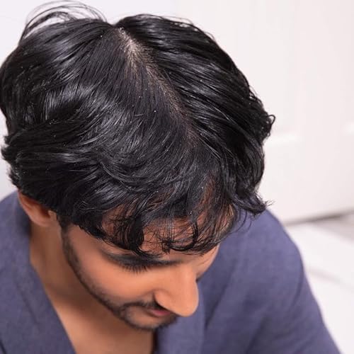 Hairitage Wash It Away Anti-Dandruff Shampoo - For Flaky, Itchy, Oily Scalp - Dandruff Shampoo Treatment - Eliminate Scalp Itching + Irritation + Flaking - 13 fl oz