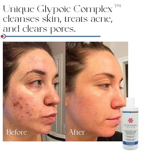 PF Reparative Facial Cleanser 8 oz, Repairs Skin, Clears away Oil and Dirt Build Up, Prevents Acne and Clogged Pores