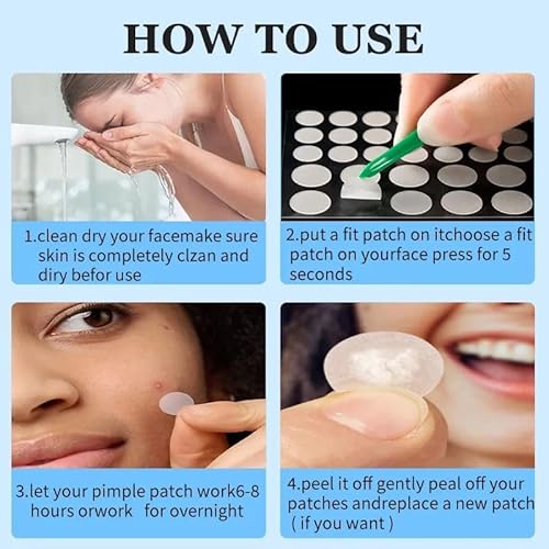ClearPatch Acne Treatment Hydrocolloid Pimple Patch (36 Patches in 1 Box) ? Invisible Acne Patch for Pimple, Blemish Healing, Skin Protection, Hypoallergenic, Day or Night Use, Unscented
