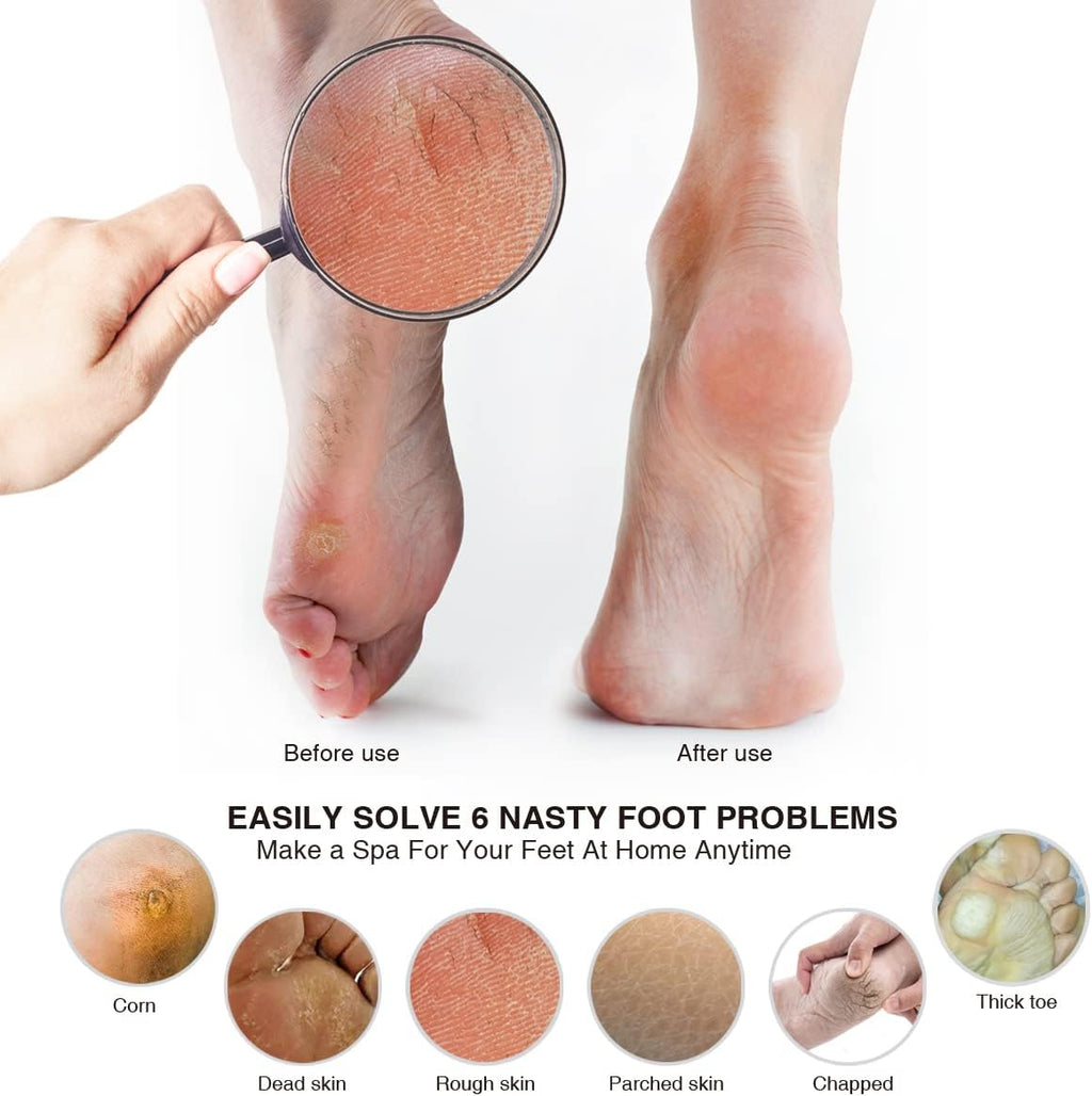Pumice Stone Foot File (2-Pack), Wooden Handle Foot Scrubber & Callus Remover for Dry, Rough Skin and Corns Pedicure