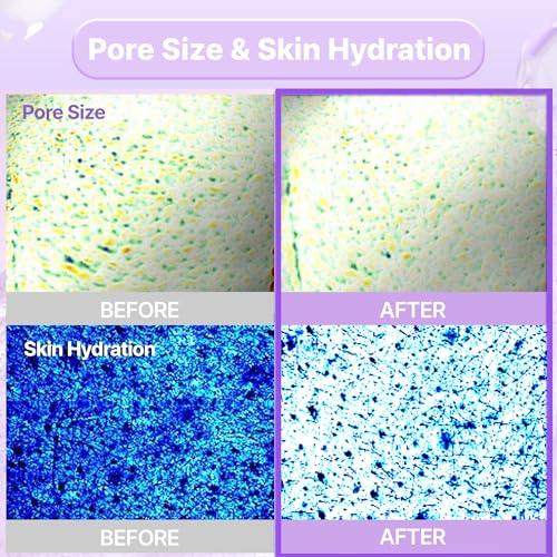 BIOHEAL BOH PROBIODERM¢â Collagen Remodeling Serum Gel Mask (6ea X 34g) | Hydrogel Mask with Collagen Capsules for Firmness & Pore Refinement | Hydrating Facial Mask for Smoother Skin