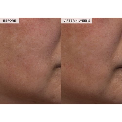 Glow Recipe PHA + BHA Face Toner - Korean Skin Care Toner, Pore Minimizer & Facial Exfoliator for Glass Skin - Tightening & Hydrating Skincare with Hyaluronic Acid & Watermelon (150ml)