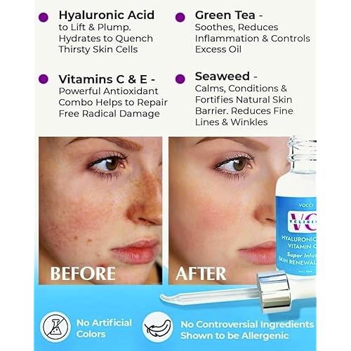 *Hyaluronic Acid Hi-C,E Antioxidant Firming Serum