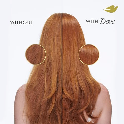 Dove Conditioner Intensive Repair for Damaged Hair with Bio-Protein Care Technology and Amino Serum 12 Fl Oz
