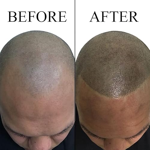 Nuva Scalp Micro-Pigmentation Ink - Customizable, Neutral Undertone for SMP Procedures, Vegan, Made in USA (Dark Brown)