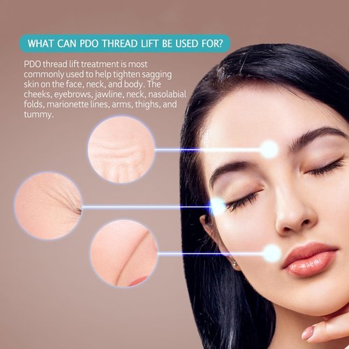 ESTEVO PDO Mono Threads Lift, for Face and Body PDO Thread For Skin Tightening and Reduce Wrinkle (20PCS-27G*60mm)