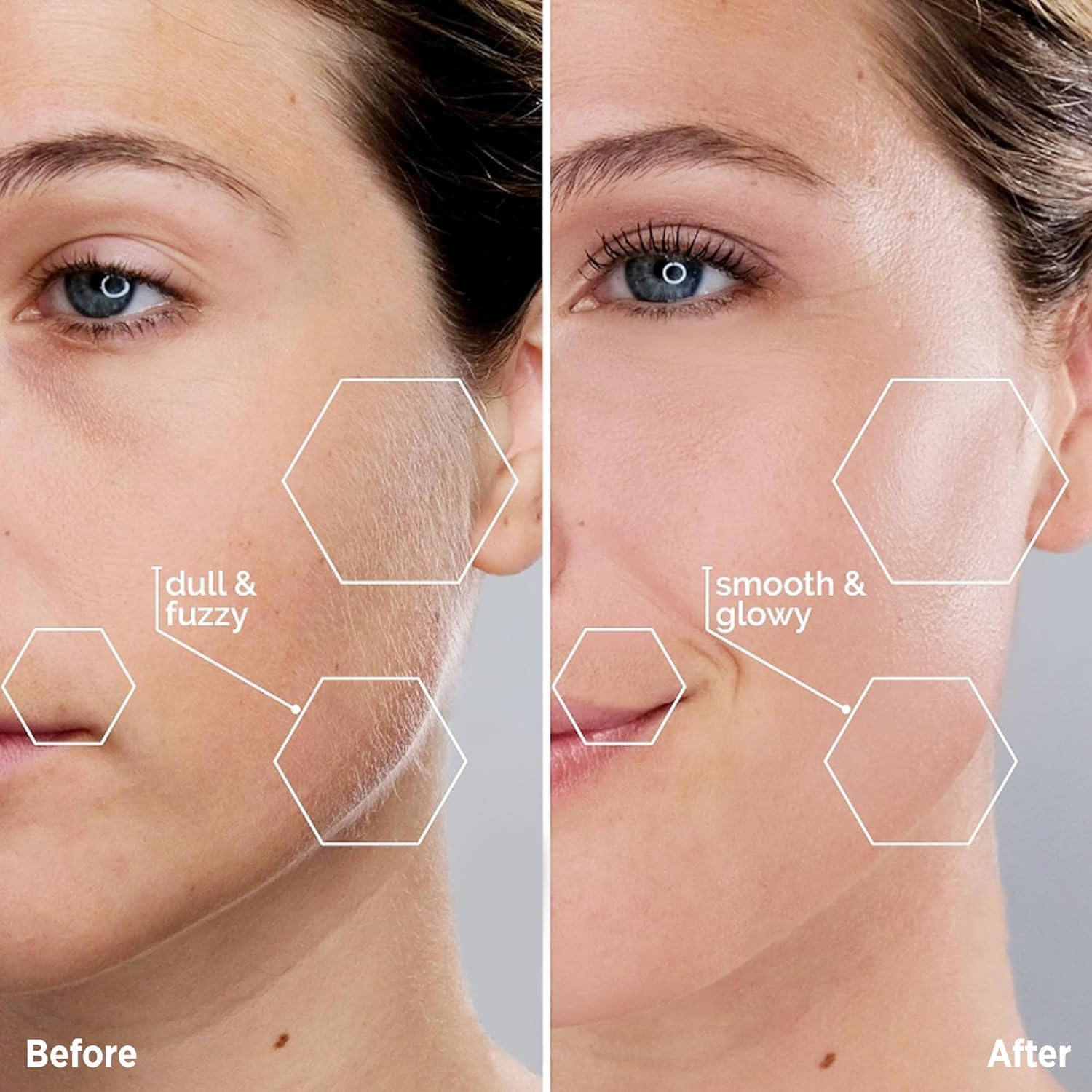 Facial Hair Removal for Women - Painless Facial Hair Remover - Electric Hair Removal Device for Face Lips Peach Fuzz with Light (Rose Gold)