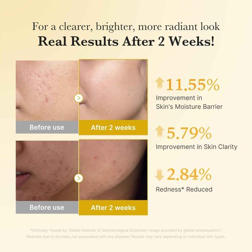 medicube Kojic Acid Overnight Care & Nourish Duo for Troubled Skin: Kojic Acid Turmeric Overnight Wrapping Peel Off Mask and Kojic Acid Turmeric Clarifying & Balancing Capsule Serum