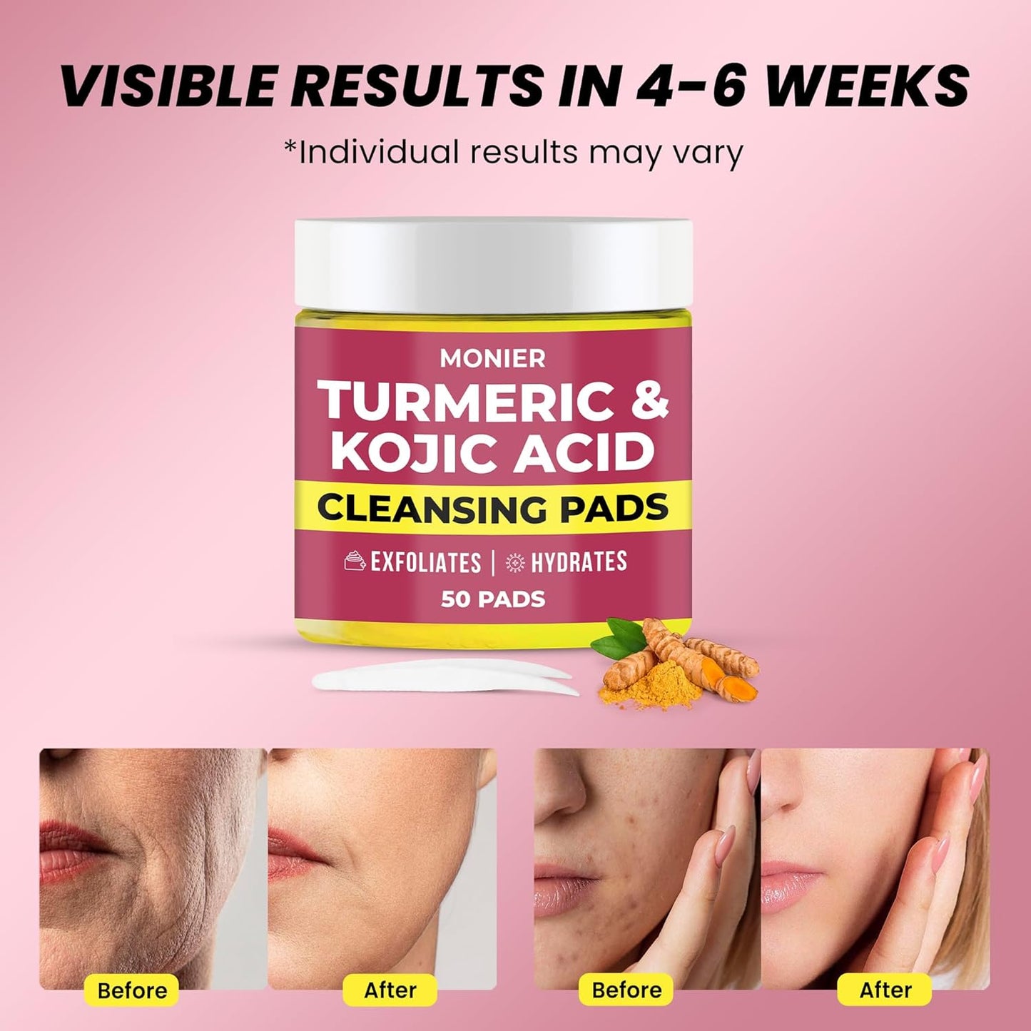 Turmeric & Kojic Acid Cleansing Pads for Dark Spots - Hydrating & Plumping - 50 Pads