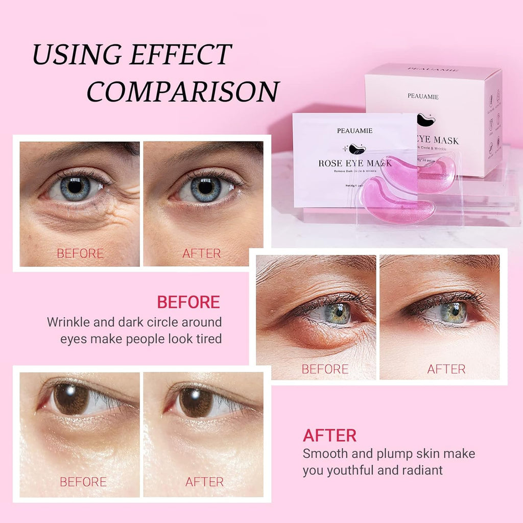 Under Eye Patches Gold and Hyaluronic Acid for puffy eyes,Rose Eye Masks for Dark Circles and Puffiness skin care Smooth Wrinkles products 30 Pairs