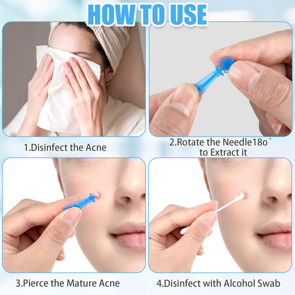 Sterile Needles for Pimples, 100Pcs Disposable Acne Needles Effective Blemish and Blackhead Removal Tools for Clear Skin