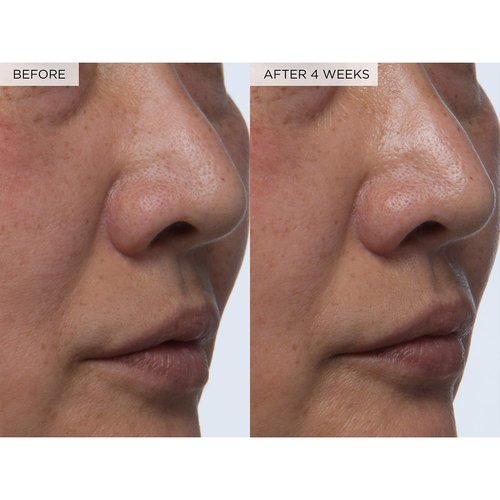Glow Recipe PHA + BHA Face Toner - Korean Skin Care Toner, Pore Minimizer & Facial Exfoliator for Glass Skin - Tightening & Hydrating Skincare with Hyaluronic Acid & Watermelon (150ml)