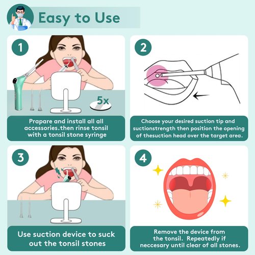 Electronic Vacuum Tonsil Stone Remover - Tonsil Stone Removal Kit with Built-in LED Light & 3 Suction Mode - Fight Bad Breath Oral Irrigator & 5X Magnifying Mirror for Tonsil Stone Removal (Green)
