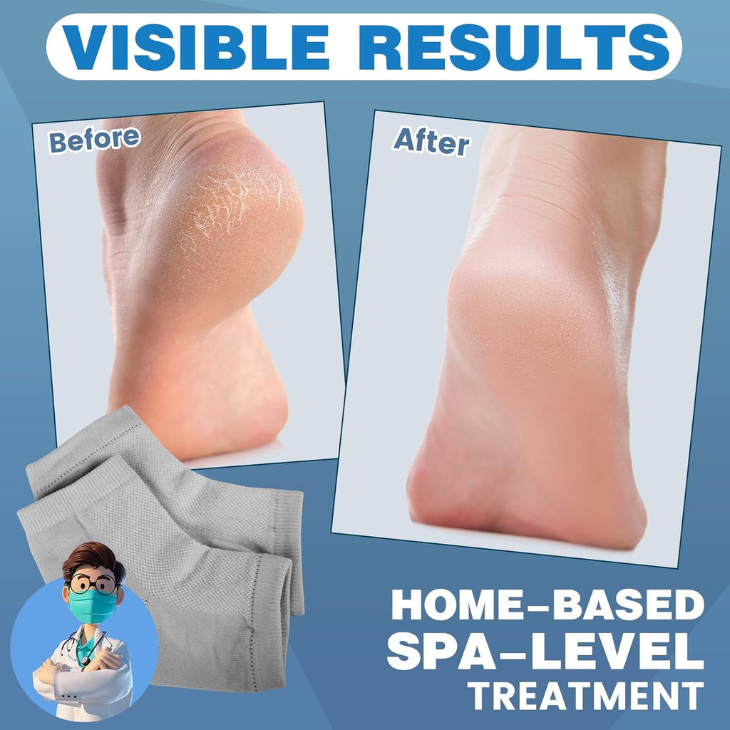 Moisturizing Heel Socks - 6 Pairs for Dry Cracked Feet, Toeless Gel Socks for Hydration and Repair